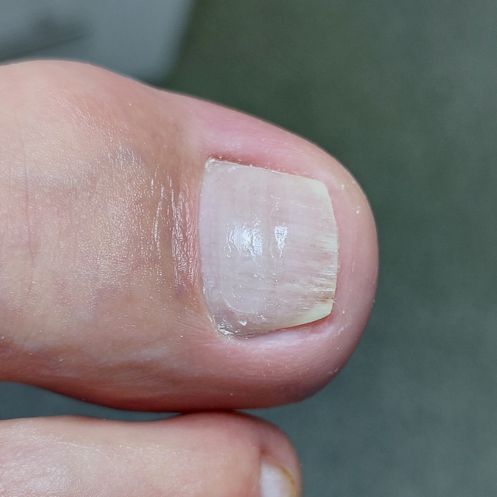 Установка коррекционной системы