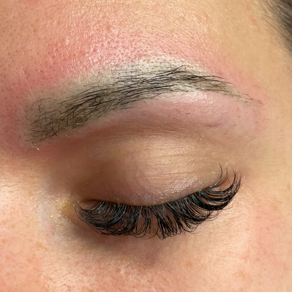 Ремувер (удаление перманента и татуажа)