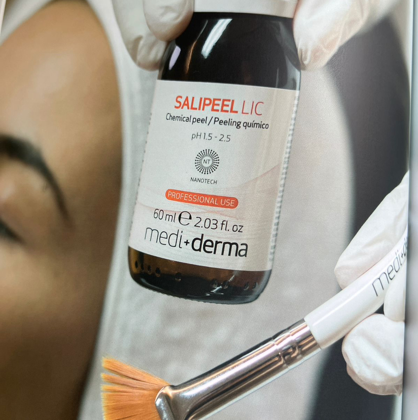 Салициловый пилинг