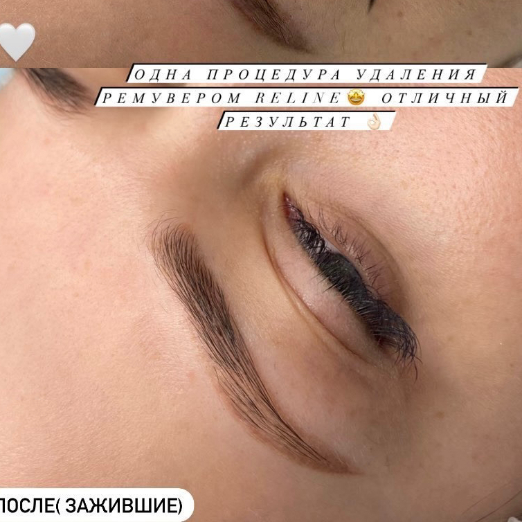 Удаление перманента ремувером