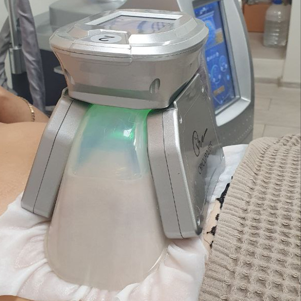 КРИОЛИПОЛИЗ