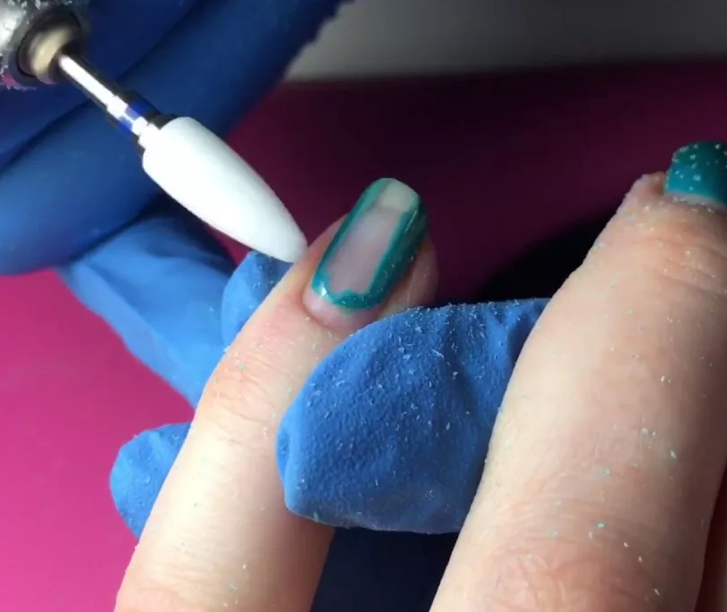 Снятие искуственного материала