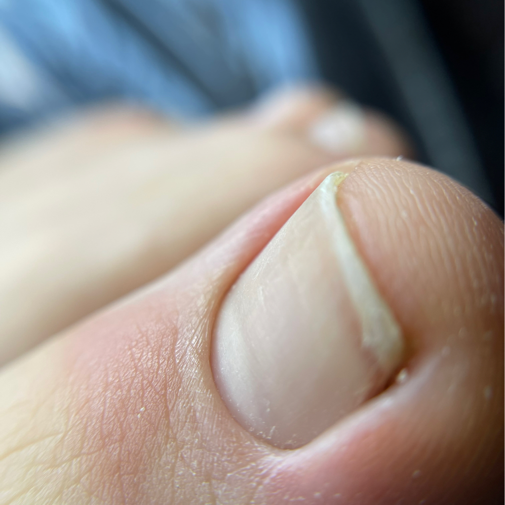 Педикюр гигиенический