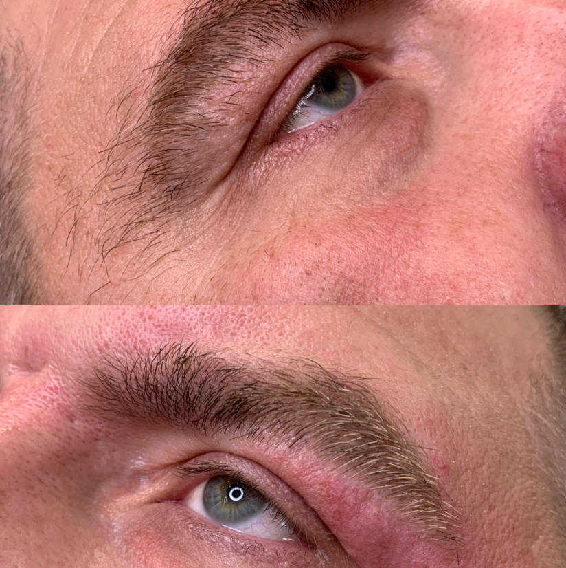 Брови (Мужчины)