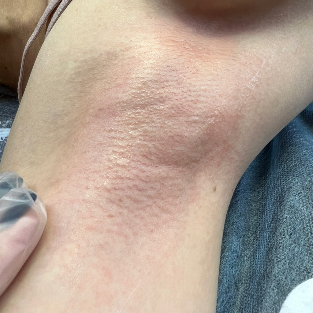 Подмышечные впадины