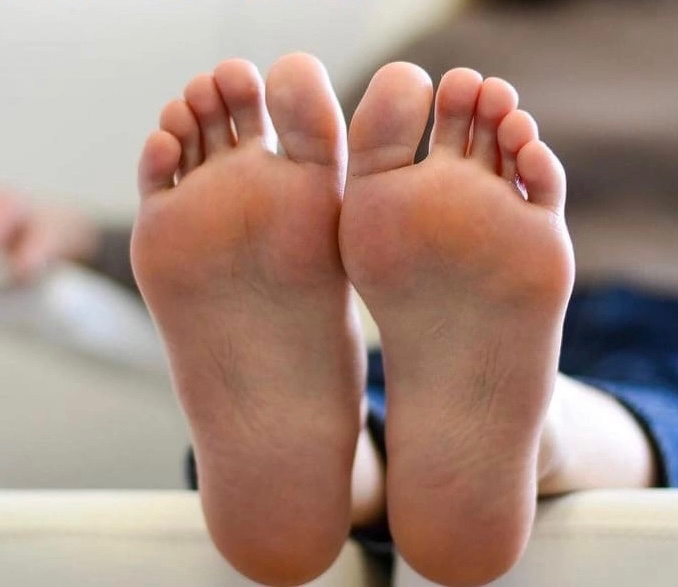 СТОПЫ без пальчиков ( мозоли, натоптыши, омозолелости, трещины)