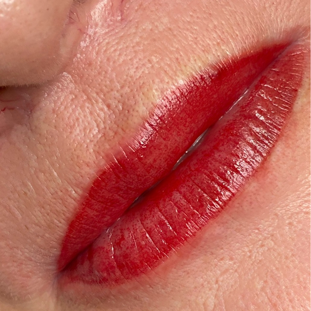 ГУБЫ -  КОРРЕКЦИЯ через 1 месяц