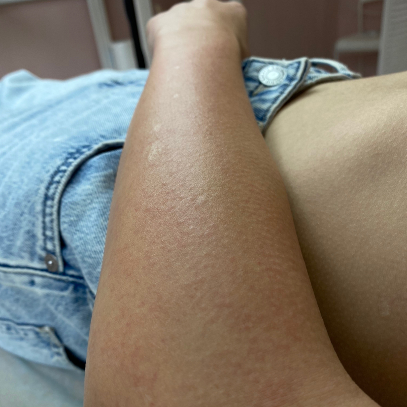 Руки до локтя