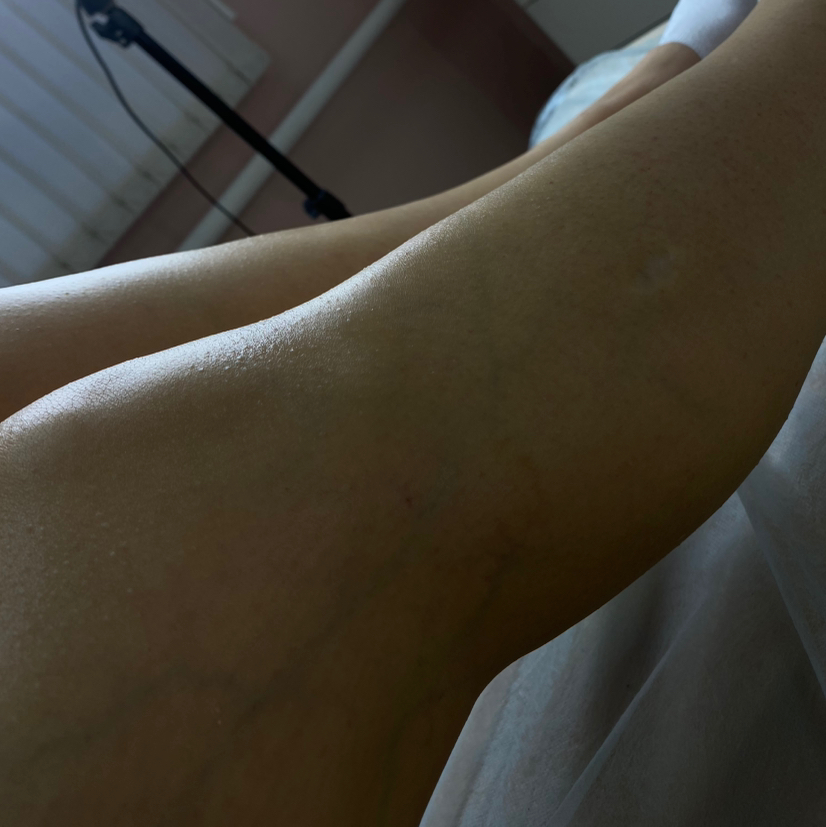 Бедро / Голень