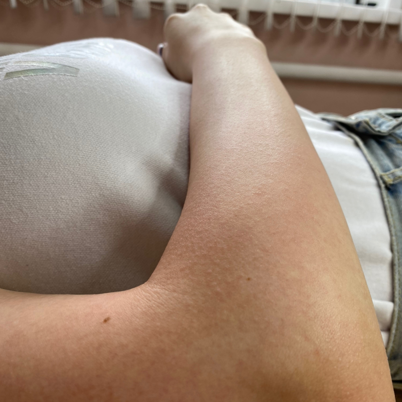 Руки полностью