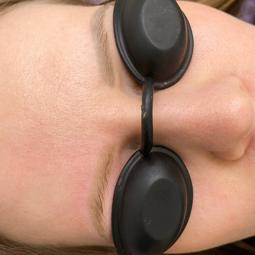 Ремувер ▫️удаление татуажа