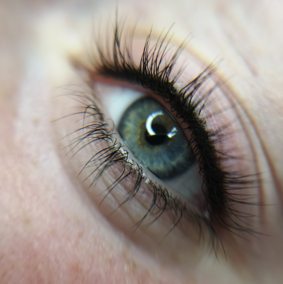 Межресничка