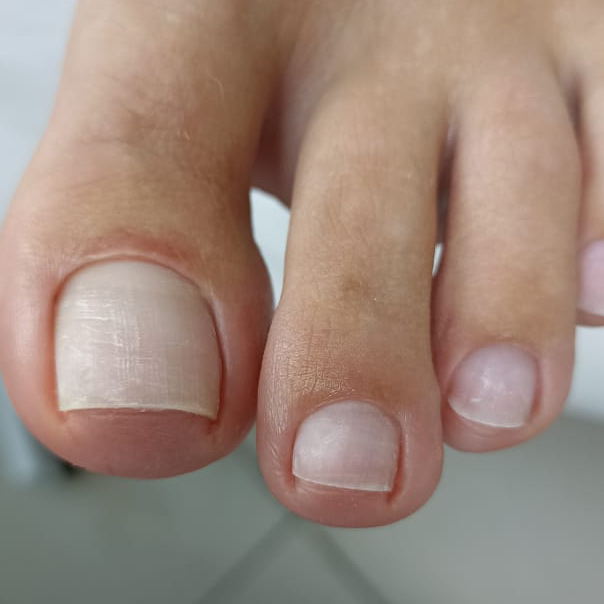 Обработка пальцев ног