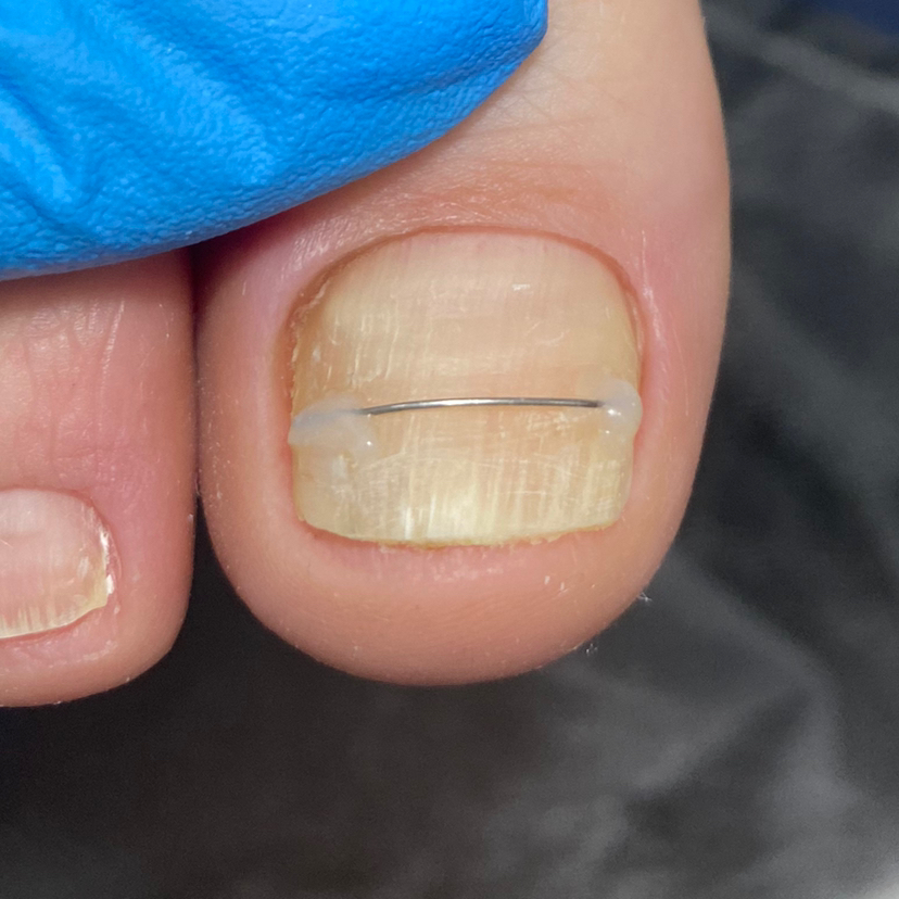 Титановая нить