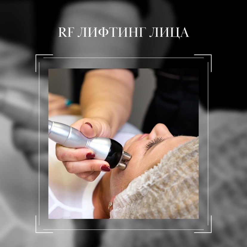 RF лифтинг лица
