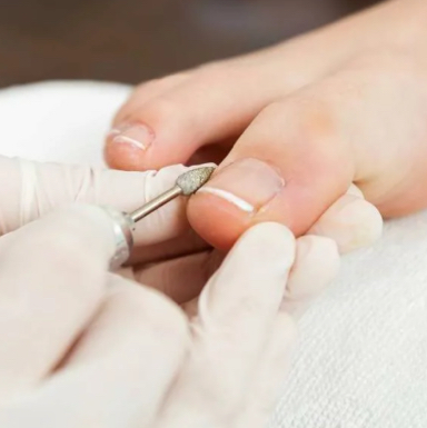 Снятие покрытия ноги