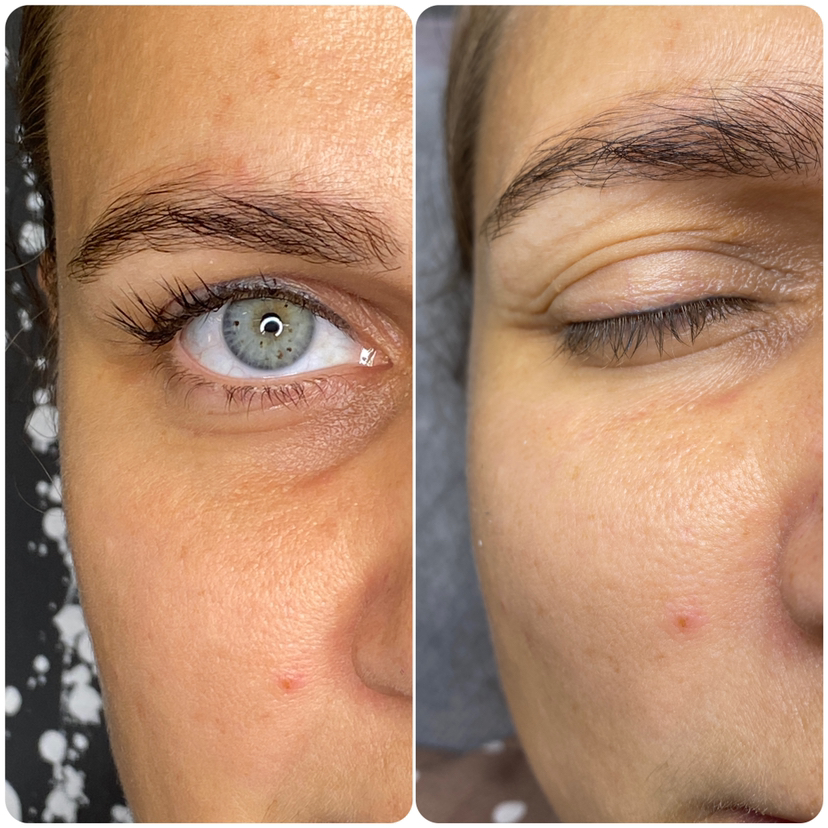 Снятие нарощенных ресниц(с ламинированием ресниц-200,отдельная процедура -400)