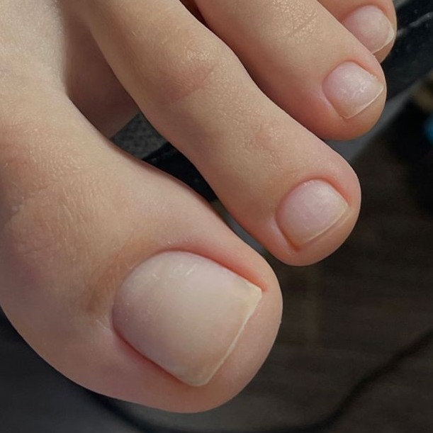 Гигиенический педикюр