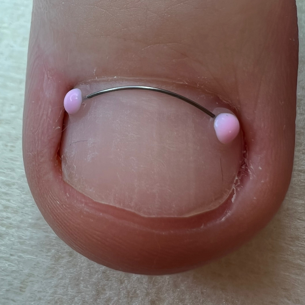 Титановая Нить