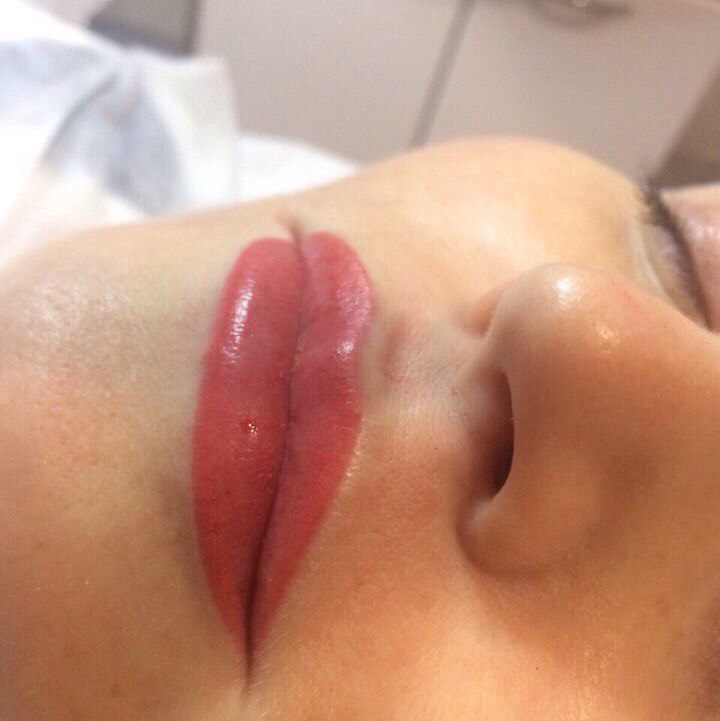 Напыление губ коррекция