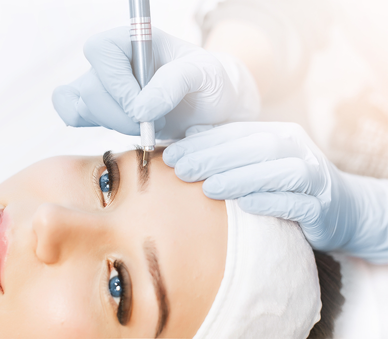 Удаление татуажа ремувером