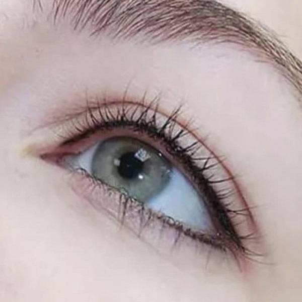 Напыление веки коррекция