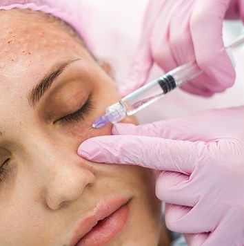 Биоревитализация  глаз  «Молодость глаз »