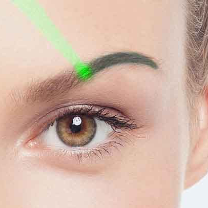 Удаление тату