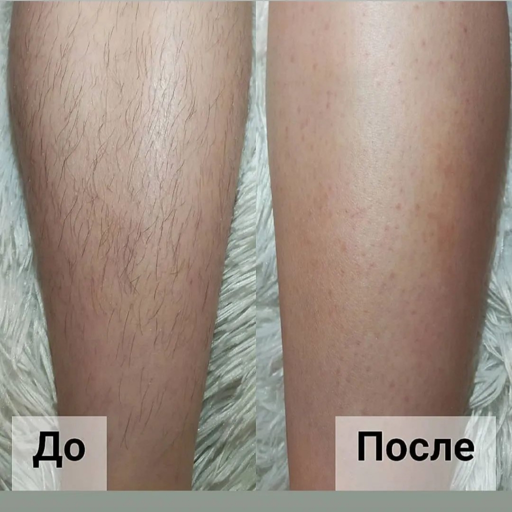 ноги до колен