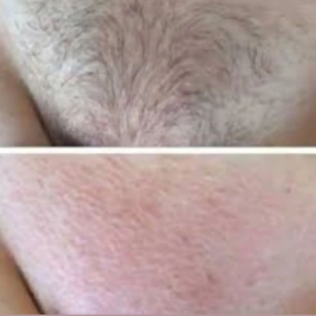 глубокий бикини