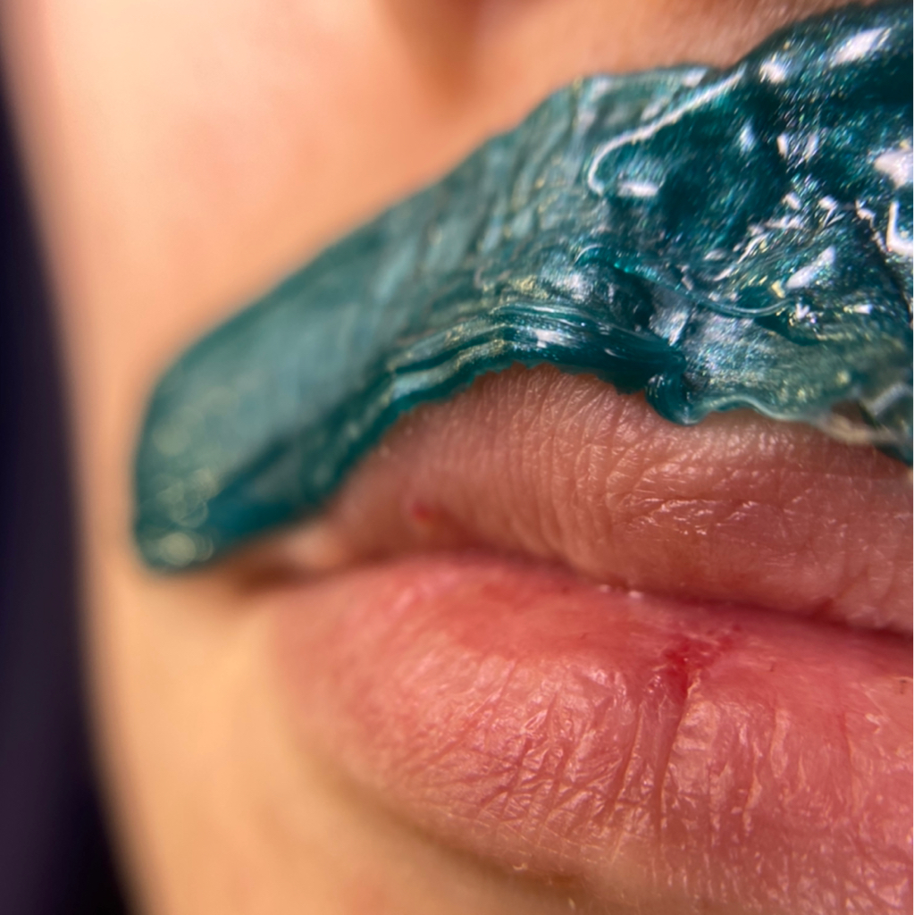 Удаление волос (над губой / под губой / подбородок)