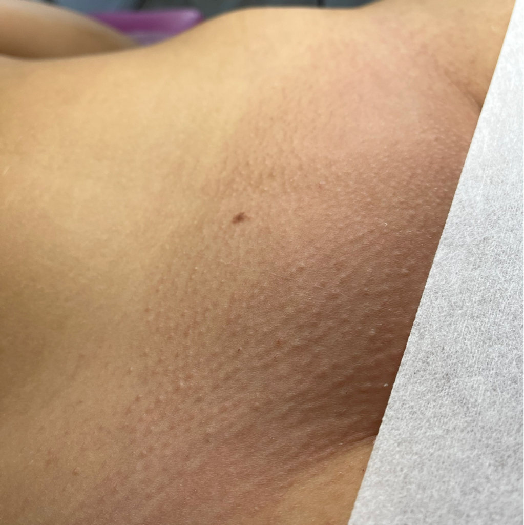 Глубокое бикини