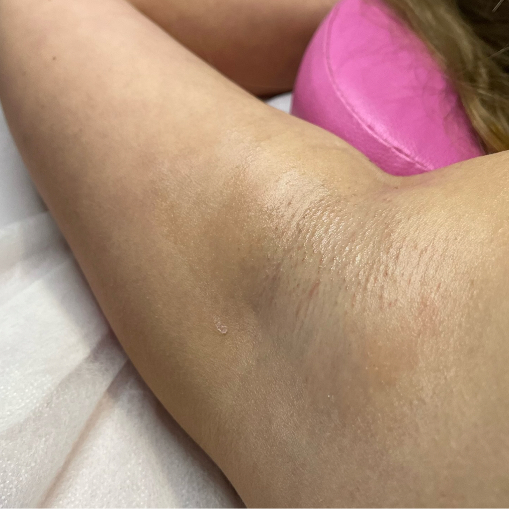 Комплект - глубокое бикини, ноги 1/2, подмышки