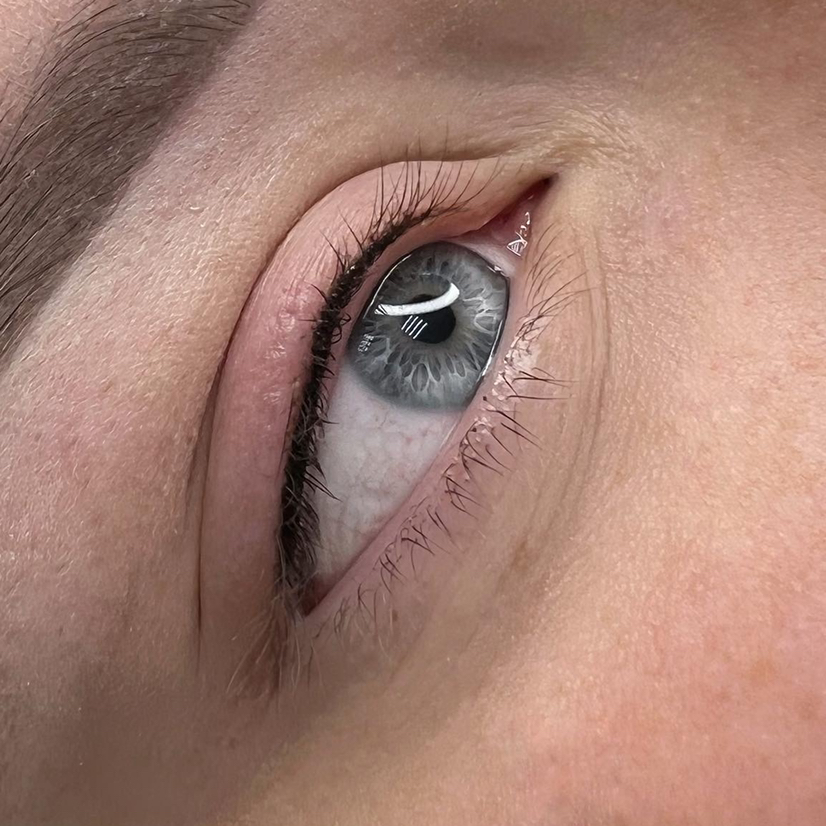 ПМ межресничка