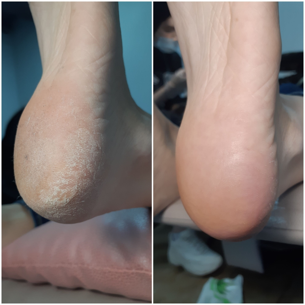 Педикюр "Только стопа"