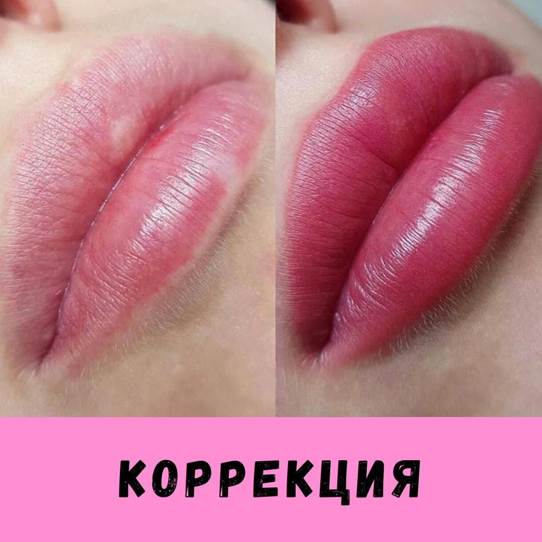 Корр. губ (2процедура) от Натальи