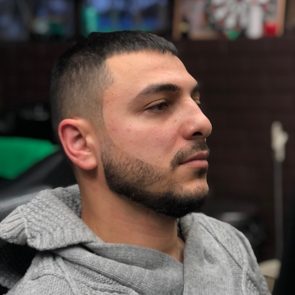 Коррекция Бороды