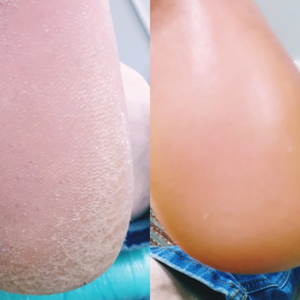 Педикюр Аппаратный Пяточка +стопа+ пальчики (без покрытия)
Кабинет 8