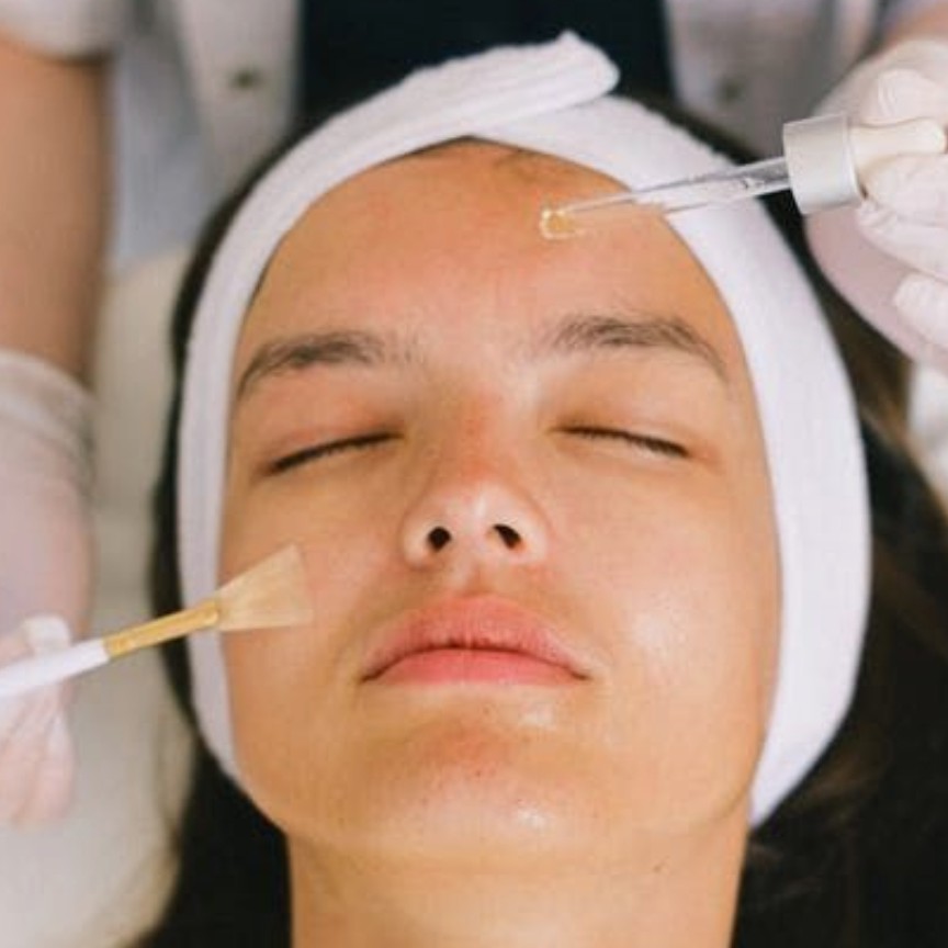 Химический пилинг Джесснера