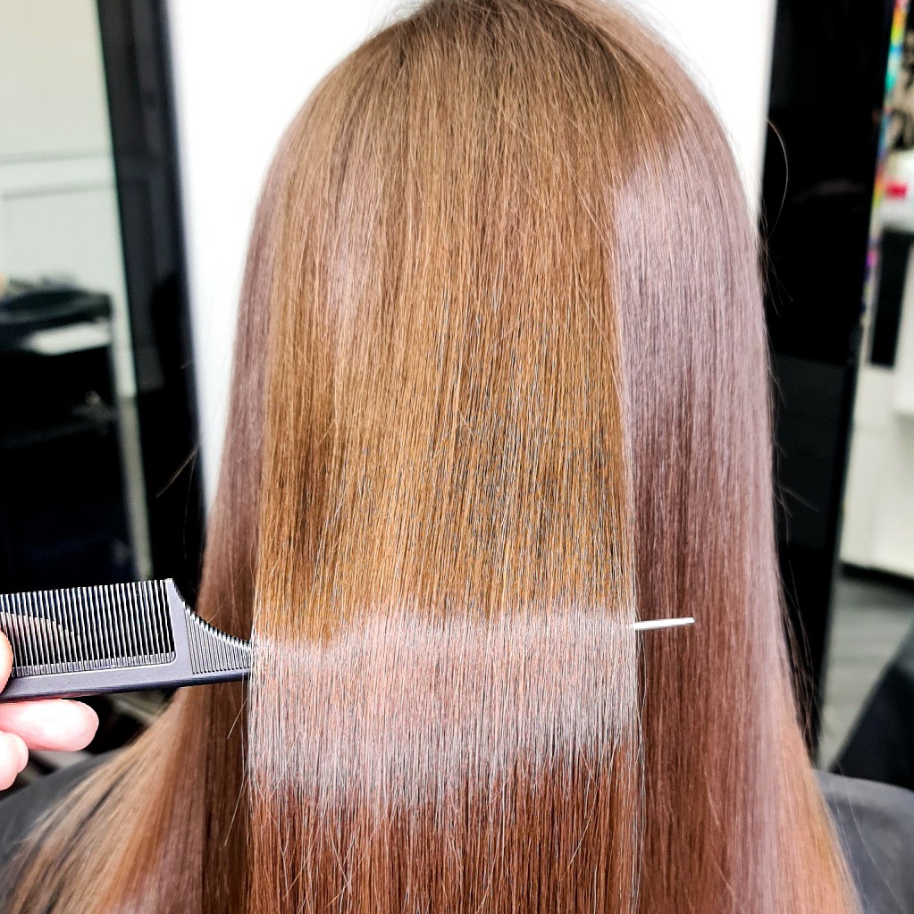 Ботокс (верхняя граница лопаток)