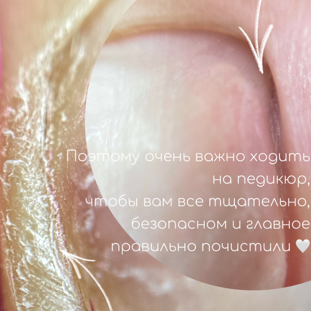 Педикюр (пальчики) без покрытия