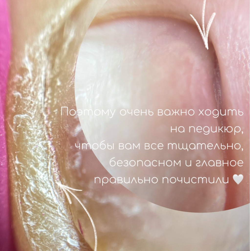 Педикюр (пальчики) без покрытия   (тампонирование вросшего ногтя входит в стоимость)