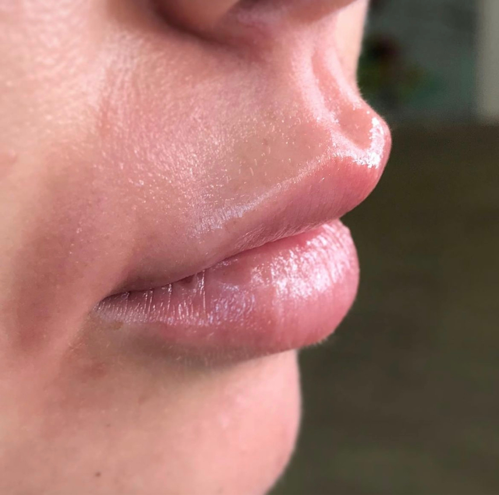 Эпиляция (лицо полностью)