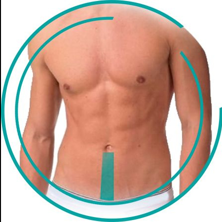 Белая линия живота (М)