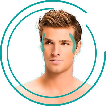 Виски (бакенбарды) (М)