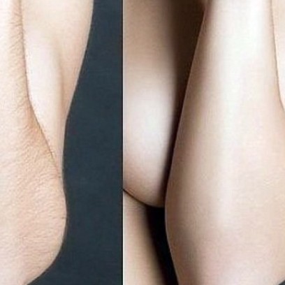 Руки полностью