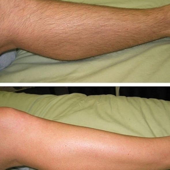 Ноги до колен