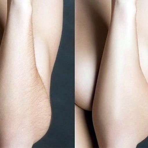 Руки до локтя