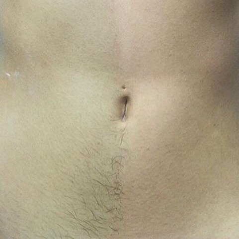 Полоска на животе