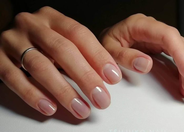 Лечебное покрытие лаком